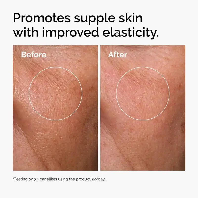 Before and after comparison of skin with improved elasticity and reduced wrinkles