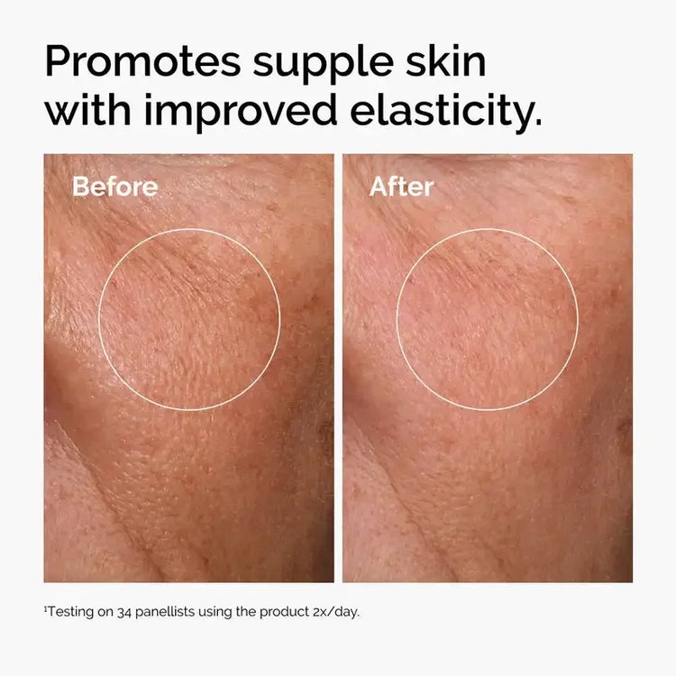 Before and after comparison of skin with improved elasticity and reduced wrinkles