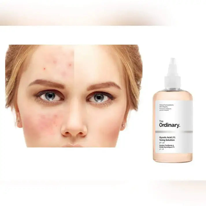 Woman's face before and after skincare, with The Ordinary Glycolic Acid 7% Toning Solution bottle