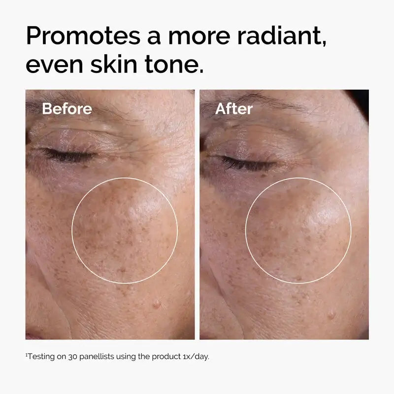 Before and after close-up of face showing improved, more even skin tone with skincare product.