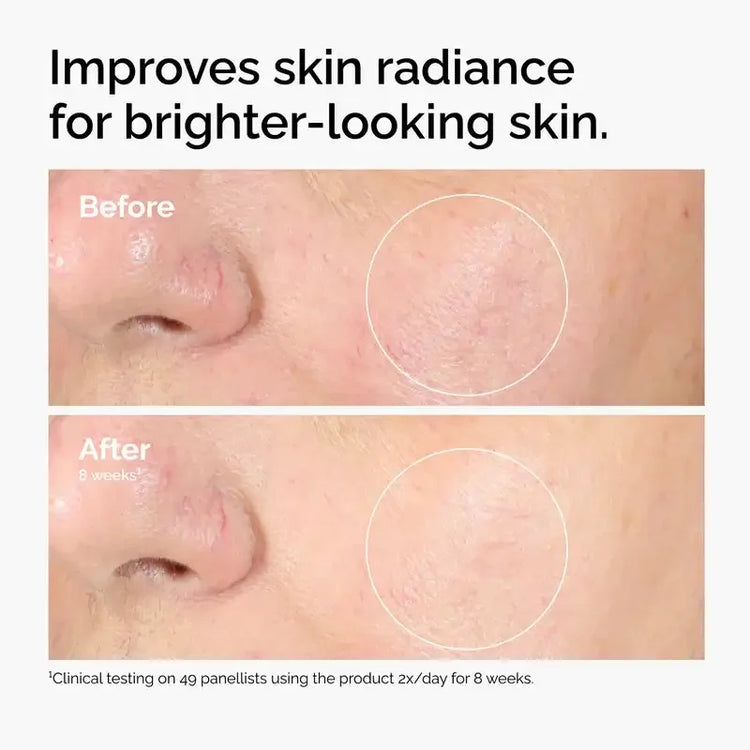 Before and after comparison of facial skin showing improved radiance and reduced dullness.