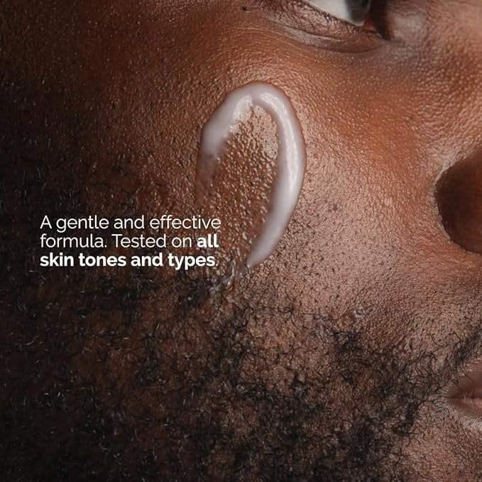 Close-up of skincare cream applied to cheek, suitable for all skin types and tones.