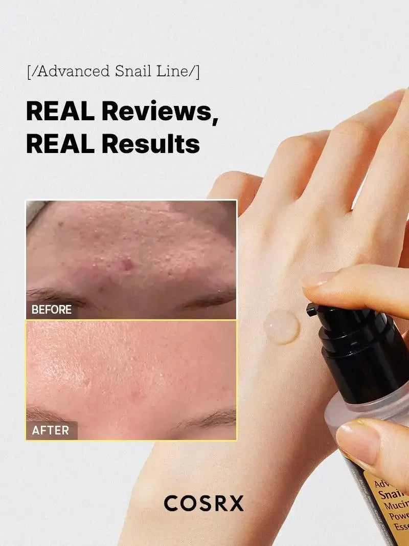 COSRX Advanced Snail Line serum with before and after results for clear, smooth skin