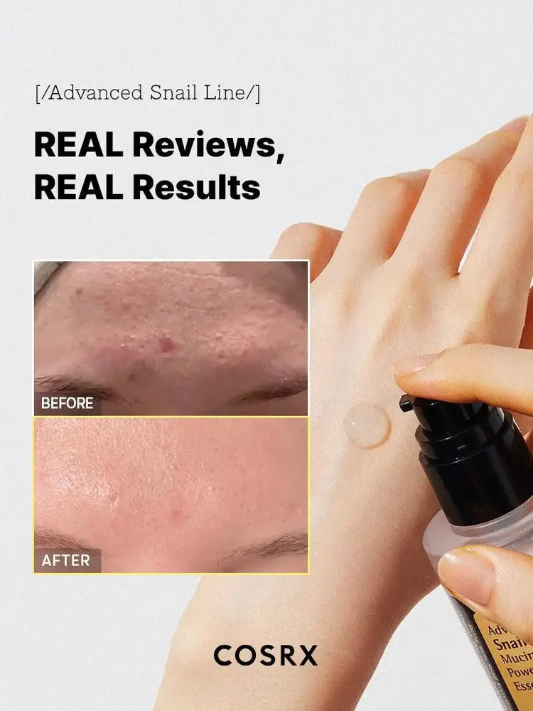 COSRX Advanced Snail Line serum with before and after results for clear, smooth skin