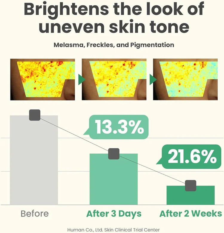 Infographic showing improvement in uneven skin tone, melasma, freckles, and pigmentation over two weeks with bar charts and skin images.