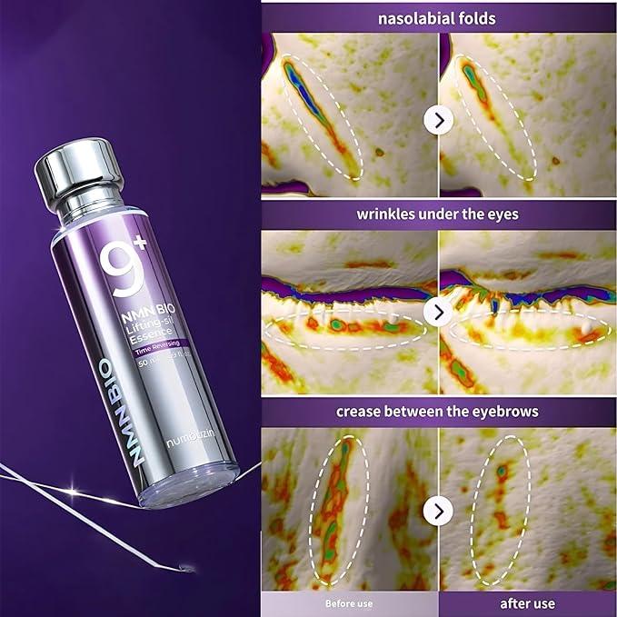 Numbuzin 9+ NMN Bio Lifting Essence bottle with before and after images showing reduced nasolabial folds, wrinkles under the eyes, and eyebrow creases.