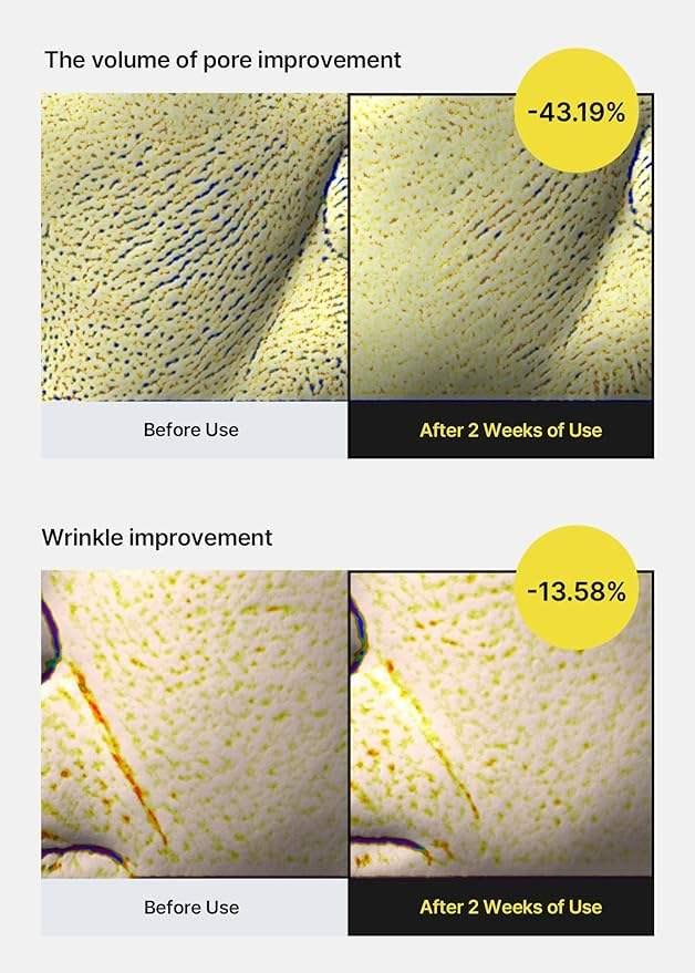 Close-up skin improvement comparison showing reduced pores and wrinkles after 2 weeks use.