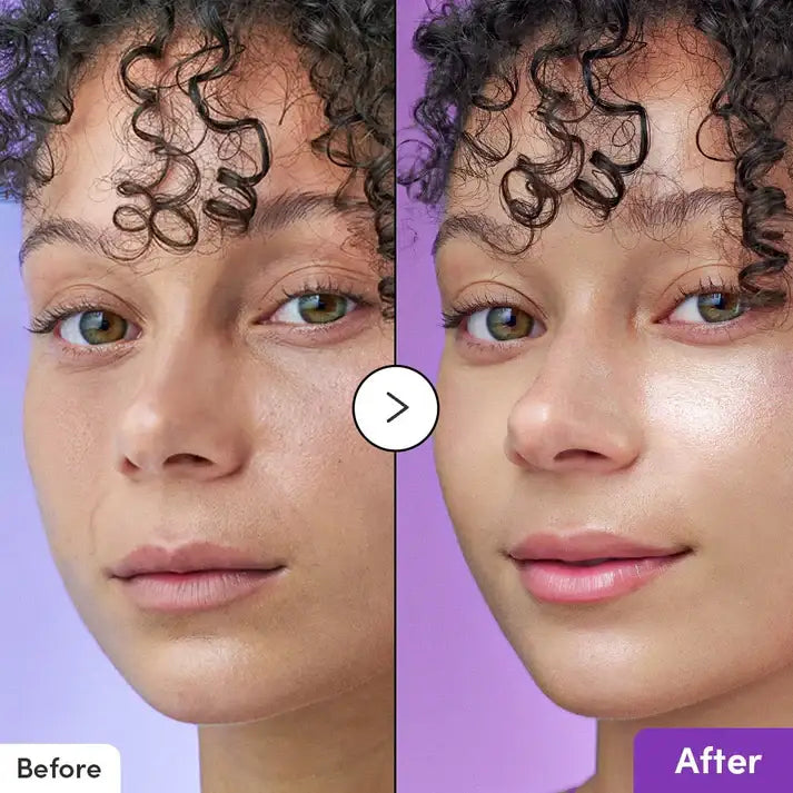 Before and after close-up of a woman's face showing smoother, glowing skin after skincare treatment