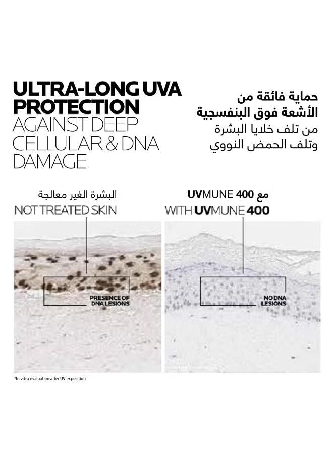 Comparison of skin cells showing UVAMUNE 400 protection against UVA-induced DNA damage