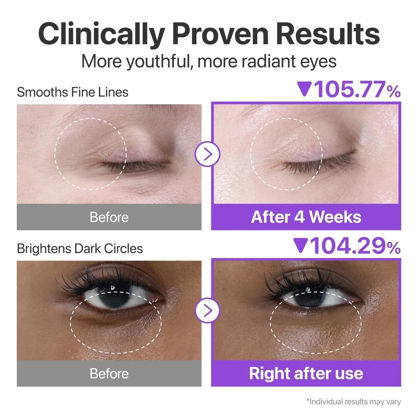Eye skincare product before and after results on fine lines and dark circles, clinical improvement shown.