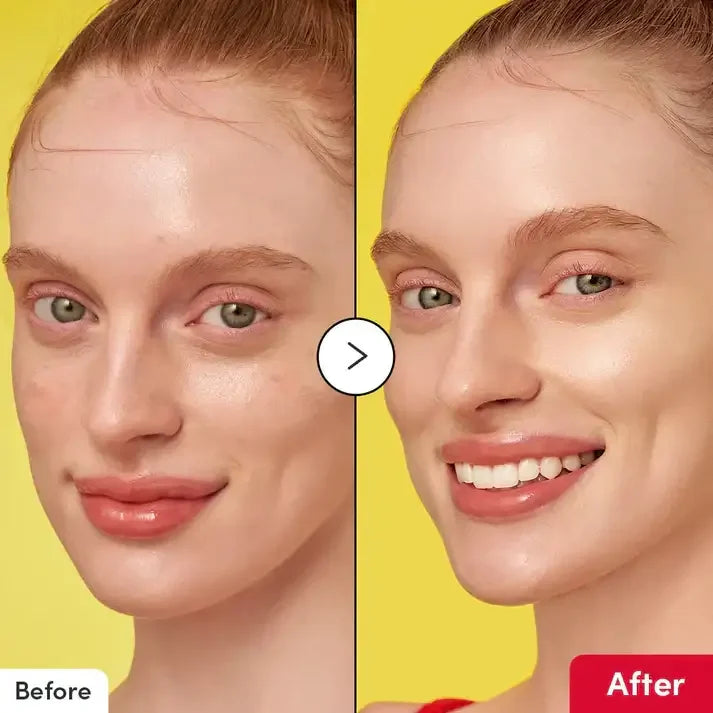 Before and after skincare results on woman's face, clear skin improvement, yellow background